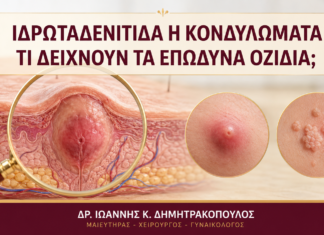 Ιδρωταδενίτιδα ή Κονδυλώματα: Τι Δείχνουν τα Επώδυνα Οζίδια; Ιδρωταδενίτιδα ή Κονδυλώματα: Τι Δείχνουν τα Επώδυνα Οζίδια; - Δρ. Ιωάννης Κ. Δημητρακόπουλος