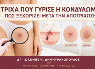 Τρίχα που Γύρισε ή Κονδύλωμα: Πώς Ξεχωρίζει μετά την Αποτρίχωση; - Δρ. Ιωάννης Κ. Δημητρακόπουλος
