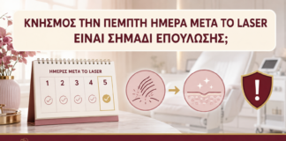 Κνησμός την Πέμπτη Ημέρα μετά το Laser: Είναι Σημάδι Επούλωσης; - Δρ. Ιωάννης Κ. Δημητρακόπουλος