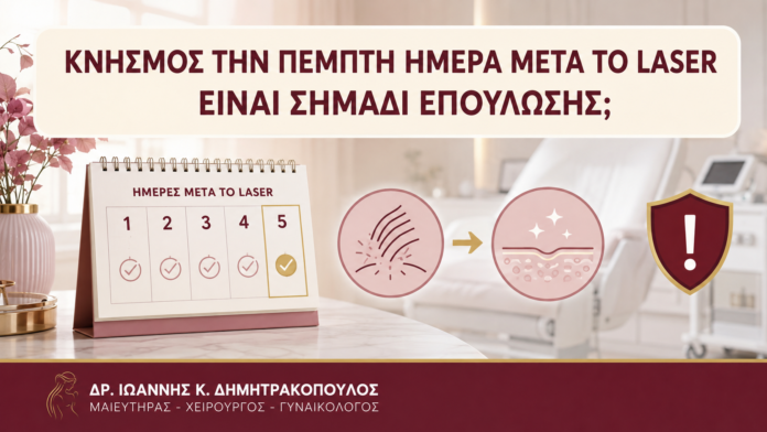 Κνησμός την Πέμπτη Ημέρα μετά το Laser: Είναι Σημάδι Επούλωσης; Κνησμός την Πέμπτη Ημέρα μετά το Laser: Είναι Σημάδι Επούλωσης; - Δρ. Ιωάννης Κ. Δημητρακόπουλος