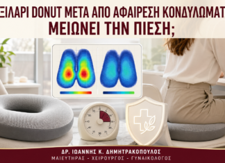 Μαξιλάρι Donut μετά από Αφαίρεση Κονδυλωμάτων: Μειώνει την Πίεση; - Δρ. Ιωάννης Κ. Δημητρακόπουλος
