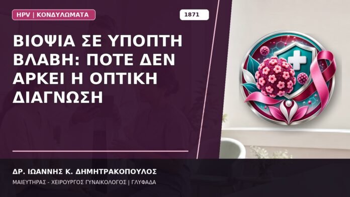 Βιοψία σε Ύποπτη Βλάβη: Πότε Δεν Αρκεί η Οπτική Διάγνωση Βιοψία σε Ύποπτη Βλάβη: Πότε Δεν Αρκεί η Οπτική Διάγνωση