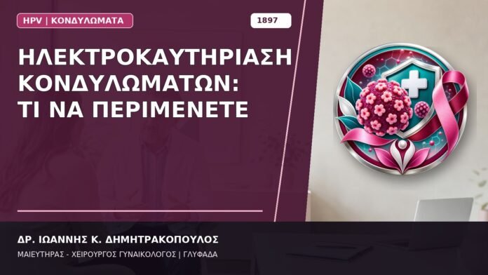 Ηλεκτροκαυτηρίαση Κονδυλωμάτων: Τι να Περιμένετε