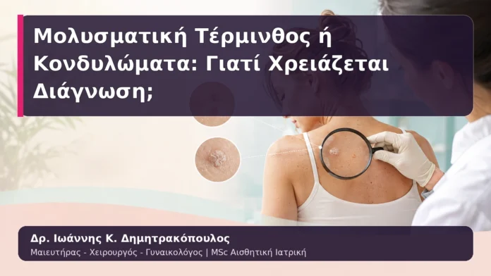 Μολυσματική Τέρμινθος ή Κονδυλώματα: Γιατί Χρειάζεται Διάγνωση;