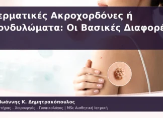 Δερματικές Ακροχορδόνες ή Κονδυλώματα: Οι Βασικές Διαφορές Δερματικές Ακροχορδόνες ή Κονδυλώματα: Οι Βασικές Διαφορές
