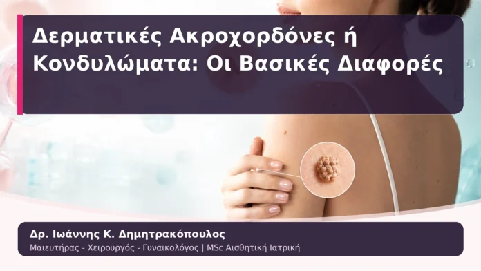 Δερματικές Ακροχορδόνες ή Κονδυλώματα: Οι Βασικές Διαφορές