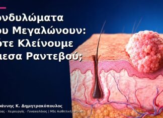 Κονδυλώματα που Μεγαλώνουν: Πότε Κλείνουμε Άμεσα Ραντεβού; Κονδυλώματα που Μεγαλώνουν: Πότε Κλείνουμε Άμεσα Ραντεβού;