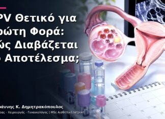 HPV Θετικό για Πρώτη Φορά: Πώς Διαβάζεται το Αποτέλεσμα; HPV Θετικό για Πρώτη Φορά: Πώς Διαβάζεται το Αποτέλεσμα;