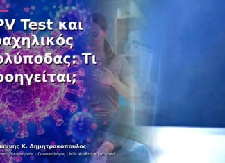 HPV Test και Τραχηλικός Πολύποδας: Τι Προηγείται;