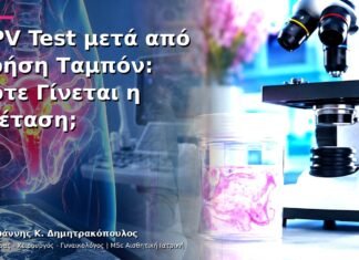 HPV Test μετά από Χρήση Ταμπόν: Πότε Γίνεται η Εξέταση;