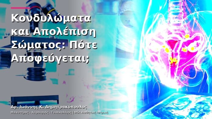 hpv-kondylomata-v13-19-10 Κονδυλώματα και Απολέπιση Σώματος: Πότε Αποφεύγεται;