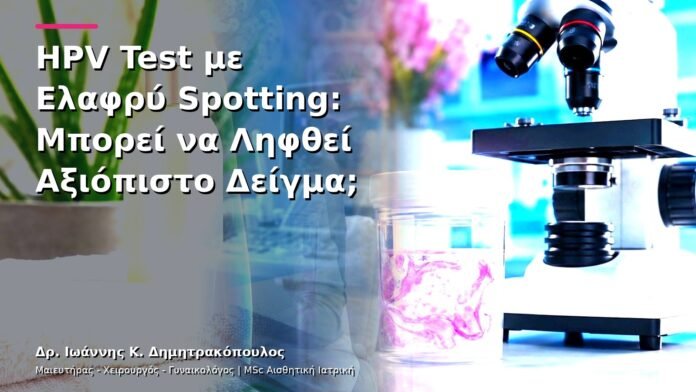 hpv-kondylomata-v13-19-5 HPV Test με Ελαφρύ Spotting: Μπορεί να Ληφθεί Αξιόπιστο Δείγμα;