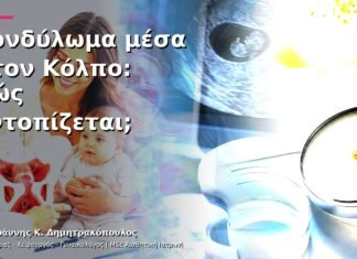 Κονδύλωμα μέσα στον Κόλπο: Πώς Εντοπίζεται; Κονδύλωμα μέσα στον Κόλπο: Πώς Εντοπίζεται;