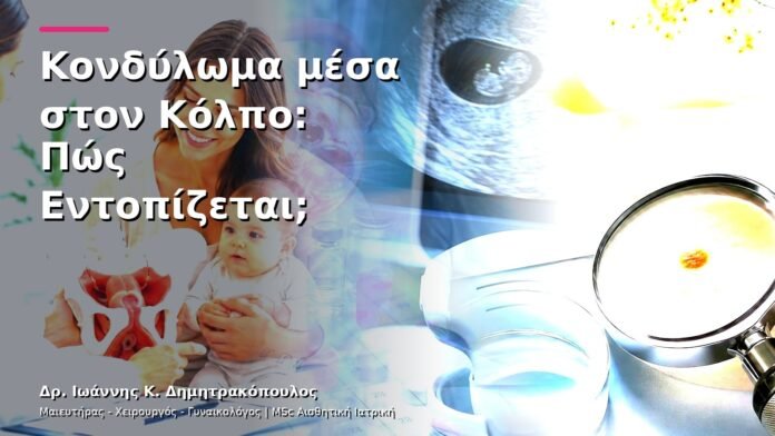 Κονδύλωμα μέσα στον Κόλπο: Πώς Εντοπίζεται;