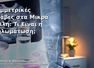 Συμμετρικές Βλάβες στα Μικρά Χείλη: Τι Είναι η Θηλωμάτωση; Συμμετρικές Βλάβες στα Μικρά Χείλη: Τι Είναι η Θηλωμάτωση;