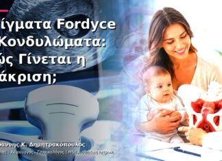 Στίγματα Fordyce ή Κονδυλώματα: Πώς Γίνεται η Διάκριση; Στίγματα Fordyce ή Κονδυλώματα: Πώς Γίνεται η Διάκριση;