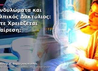 Κονδυλώματα και Κολπικός Δακτύλιος: Πότε Χρειάζεται Αφαίρεση; Κονδυλώματα και Κολπικός Δακτύλιος: Πότε Χρειάζεται Αφαίρεση;