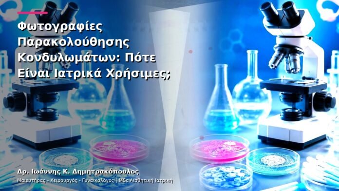 hpv-kondylomata-v13-41-5 Φωτογραφίες Παρακολούθησης Κονδυλωμάτων: Πότε Είναι Ιατρικά Χρήσιμες;