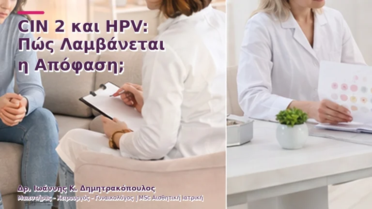 CIN 2 και HPV: Πώς Λαμβάνεται η Απόφαση;