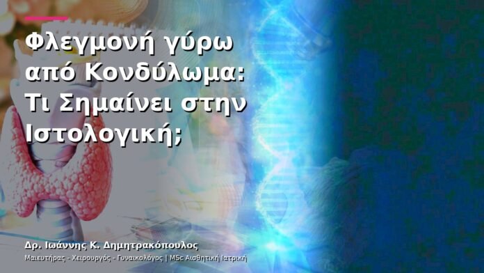 Φλεγμονή γύρω από Κονδύλωμα: Τι Σημαίνει στην Ιστολογική;