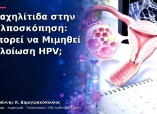 Τραχηλίτιδα στην Κολποσκόπηση: Μπορεί να Μιμηθεί Αλλοίωση HPV; Τραχηλίτιδα στην Κολποσκόπηση: Μπορεί να Μιμηθεί Αλλοίωση HPV;