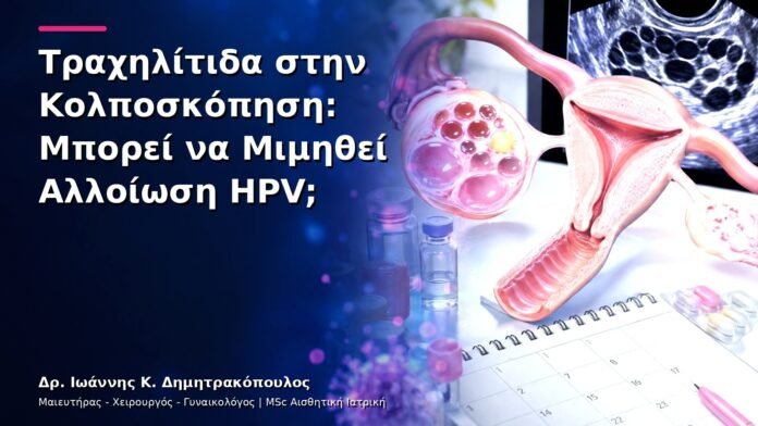 hpv-kondylomata-v28-17 Τραχηλίτιδα στην Κολποσκόπηση: Μπορεί να Μιμηθεί Αλλοίωση HPV;
