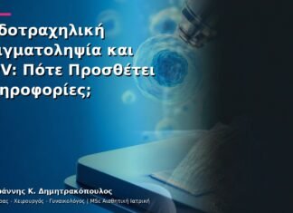 Ενδοτραχηλική Δειγματοληψία και HPV: Πότε Προσθέτει Πληροφορίες; Ενδοτραχηλική Δειγματοληψία και HPV: Πότε Προσθέτει Πληροφορίες;