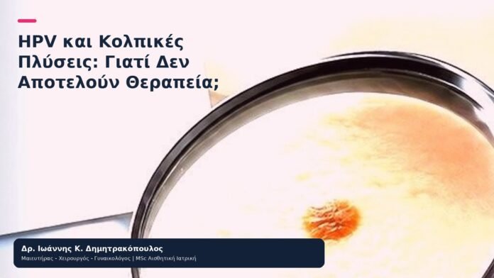 HPV και Κολπικές Πλύσεις: Γιατί Δεν Αποτελούν Θεραπεία; HPV και Κολπικές Πλύσεις: Γιατί Δεν Αποτελούν Θεραπεία; - Δρ. Ιωάννης Κ. Δημητρακόπουλος
