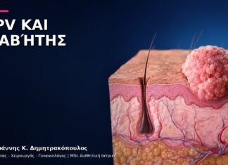 HPV και Διαβήτης: Πότε Χρειάζεται Συχνότερη Ιατρική Εκτίμηση;