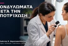 Κονδυλώματα μετά την Αποτρίχωση: Ερεθισμός ή Βλάβη HPV;