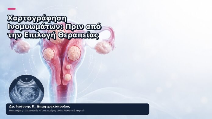 Χαρτογράφηση Ινομυωμάτων: Πριν από την Επιλογή Θεραπείας - Δρ. Ιωάννης Κ. Δημητρακόπουλος