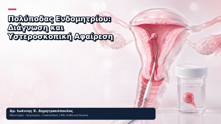 Πολύποδας Ενδομητρίου: Διάγνωση και Υστεροσκοπική Αφαίρεση - Δρ. Ιωάννης Κ. Δημητρακόπουλος
