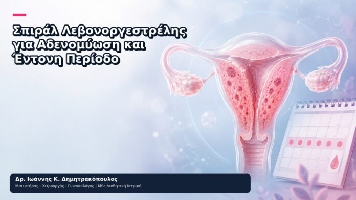 Σπιράλ Λεβονοργεστρέλης για Αδενομύωση και Έντονη Περίοδο Σπιράλ Λεβονοργεστρέλης για Αδενομύωση και Έντονη Περίοδο - Δρ. Ιωάννης Κ. Δημητρακόπουλος