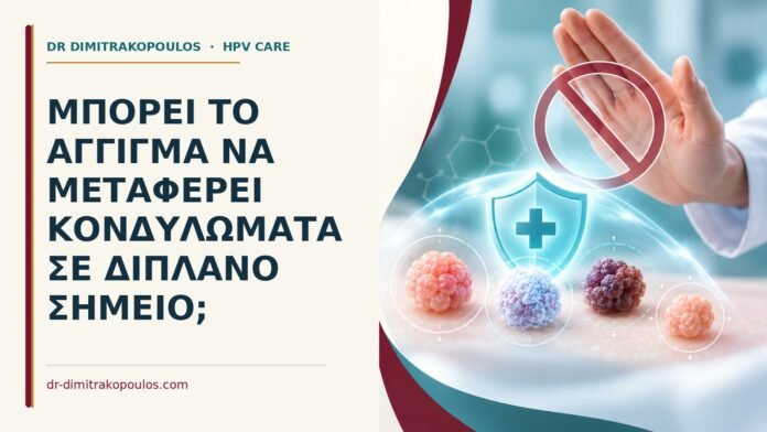 Μπορεί το άγγιγμα να μεταφέρει κονδυλώματα σε διπλανό σημείο Ιατρικό cover για: Μπορεί το άγγιγμα να μεταφέρει κονδυλώματα σε διπλανό σημείο
