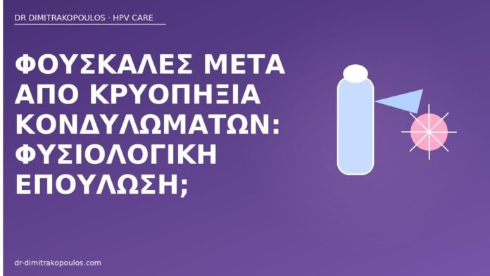 Φουσκάλες μετά από κρυοπηξία κονδυλωμάτων: φυσιολογική επούλωση; φουσκάλες κρυοπηξία κονδυλώματα