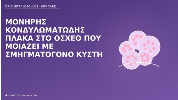 Μονήρης κονδυλωματώδης πλάκα στο όσχεο που μοιάζει με σμηγματογόνο κύστη κονδύλωμα όσχεο κύστη