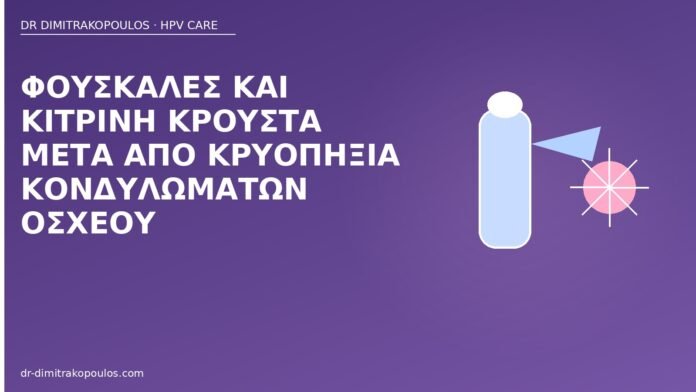 Φουσκάλες και κίτρινη κρούστα μετά από κρυοπηξία κονδυλωμάτων οσχέου φουσκάλες κρυοπηξία όσχεο