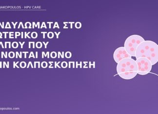 Κονδυλώματα στο εσωτερικό του κόλπου που φαίνονται μόνο στην κολποσκόπηση κονδυλώματα εσωτερικός κόλπος