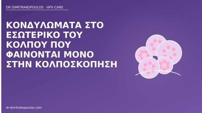 κονδυλώματα εσωτερικός κόλπος