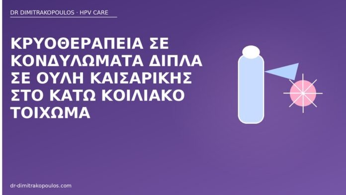 Κρυοθεραπεία σε κονδυλώματα δίπλα σε ουλή καισαρικής στο κάτω κοιλιακό τοίχωμα κρυοθεραπεία κονδυλώματα ουλή καισαρικής