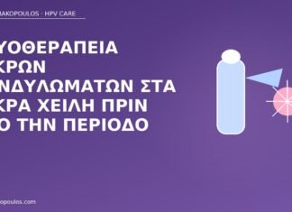 κρυοθεραπεία μικρά χείλη πριν περίοδο