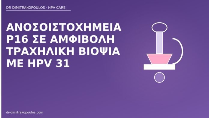 Ανοσοϊστοχημεία p16 σε αμφίβολη τραχηλική βιοψία με HPV 31 p16 βιοψία τραχήλου HPV 31