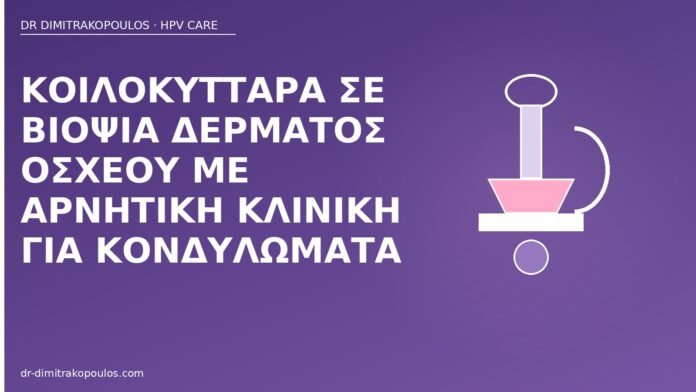 Κοιλοκύτταρα σε βιοψία δέρματος οσχέου με αρνητική κλινική για κονδυλώματα κοιλοκύτταρα βιοψία οσχέου