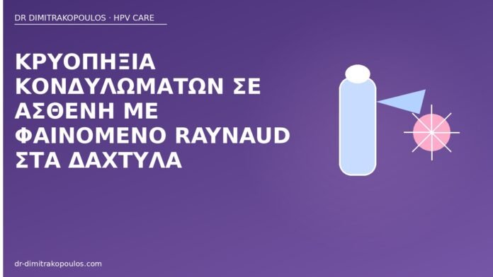 Κρυοπηξία κονδυλωμάτων σε ασθενή με φαινόμενο Raynaud στα δάχτυλα κρυοπηξία Raynaud κονδυλώματα