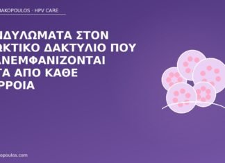 Κονδυλώματα στον πρωκτικό δακτύλιο που επανεμφανίζονται μετά από κάθε διάρροια κονδυλώματα πρωκτός διάρροια