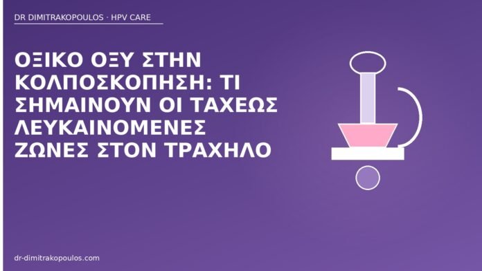 οξικό οξύ κολποσκόπηση λευκές ζώνες