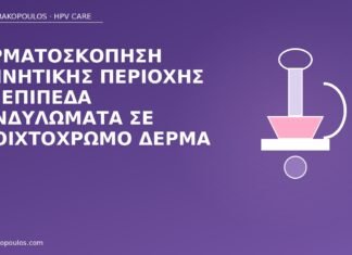 Δερματοσκόπηση γεννητικής περιοχής για επίπεδα κονδυλώματα σε ανοιχτόχρωμο δέρμα δερματοσκόπηση επίπεδα κονδυλώματα