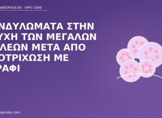 κονδυλώματα μεγάλα χείλη