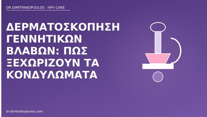 Δερματοσκόπηση γεννητικών βλαβών: πώς ξεχωρίζουν τα κονδυλώματα δερματοσκόπηση κονδυλώματα