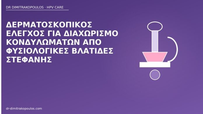 Δερματοσκοπικός έλεγχος για διαχωρισμό κονδυλωμάτων από φυσιολογικές βλατίδες στεφάνης δερματοσκόπηση βλατίδες στεφάνης